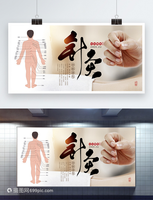 针灸 中医文化的简约与大气