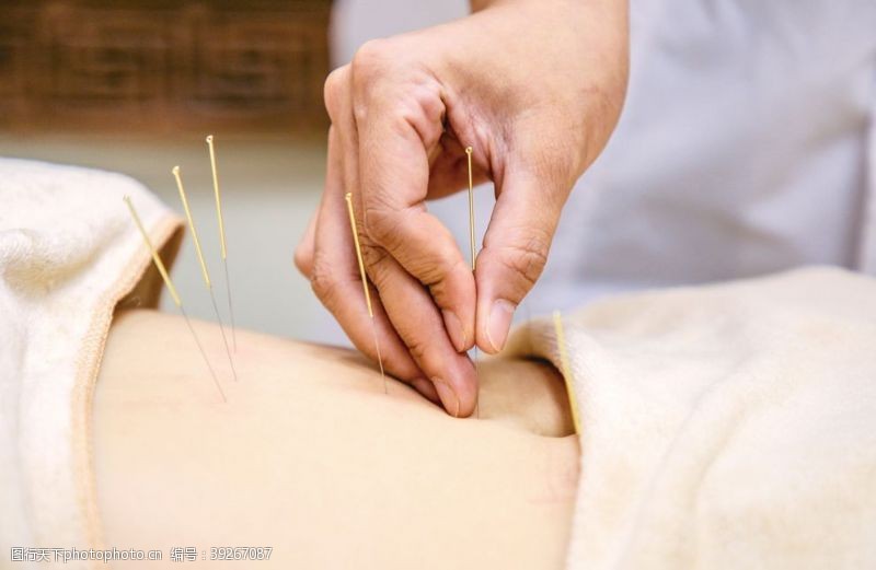 针灸 古老智慧的养身之道