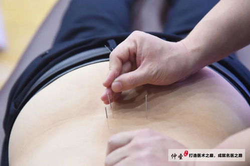 元气针灸，针道无极 一场让师友直呼“太值了”的精品讲座