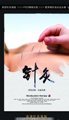 针灸 古老医学的现代应用