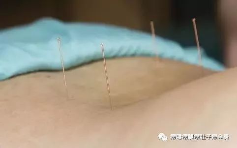 针灸减肥 至少半年的坚持与效果