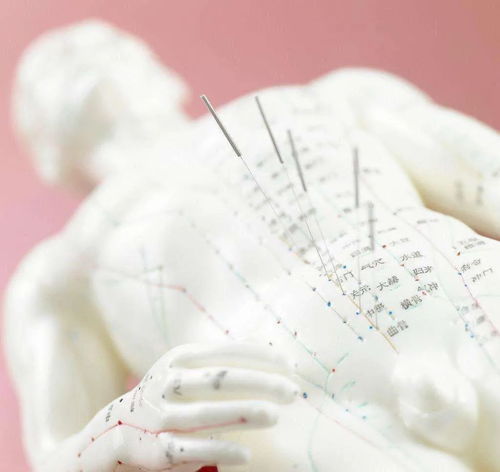 诊所针灸事故频发 深刻教训与防范之道